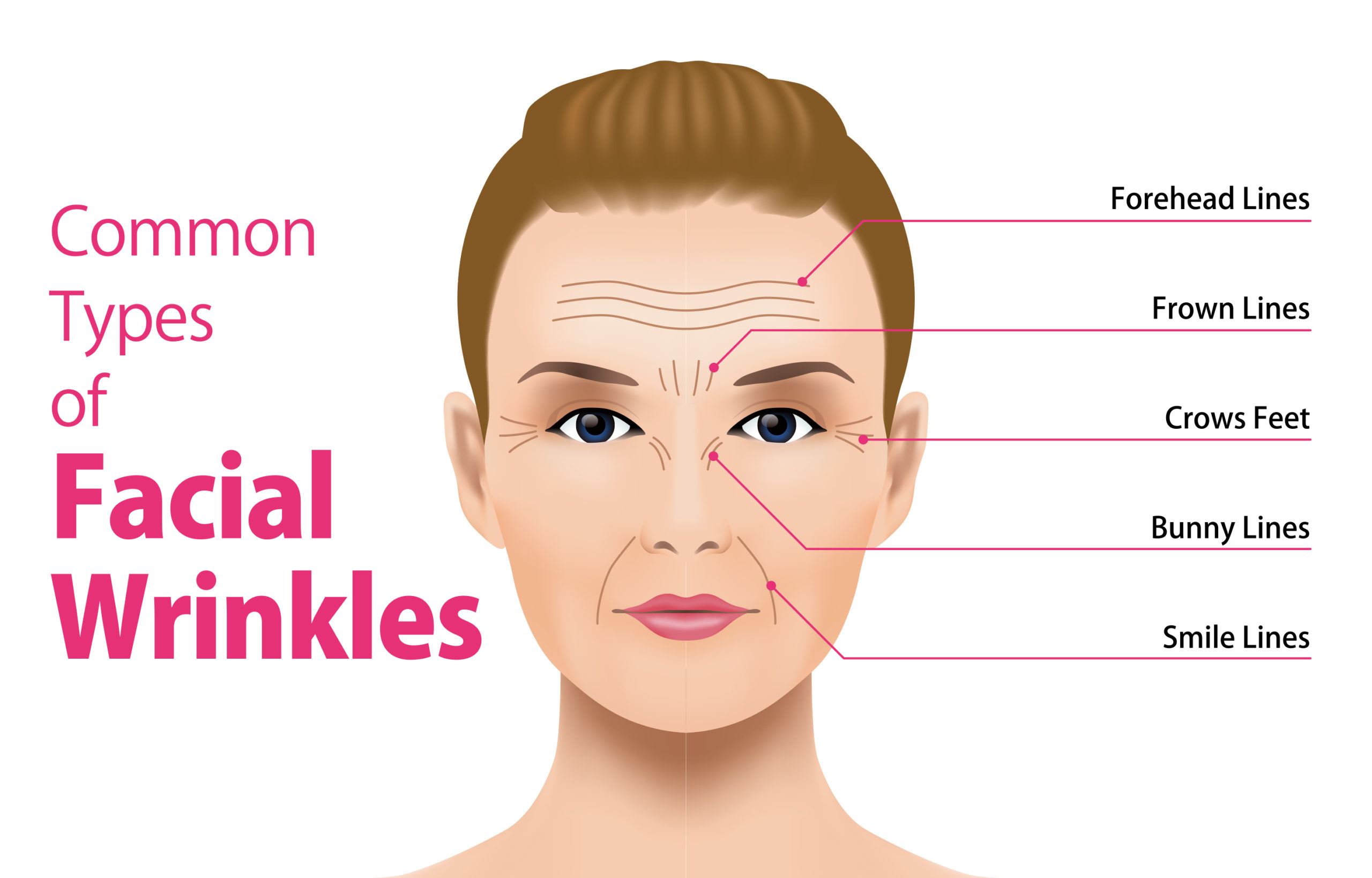 botox-facial-wrinkles