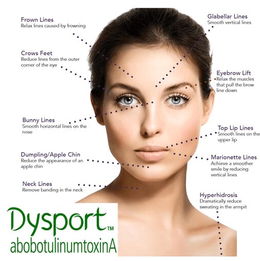 dysport-image