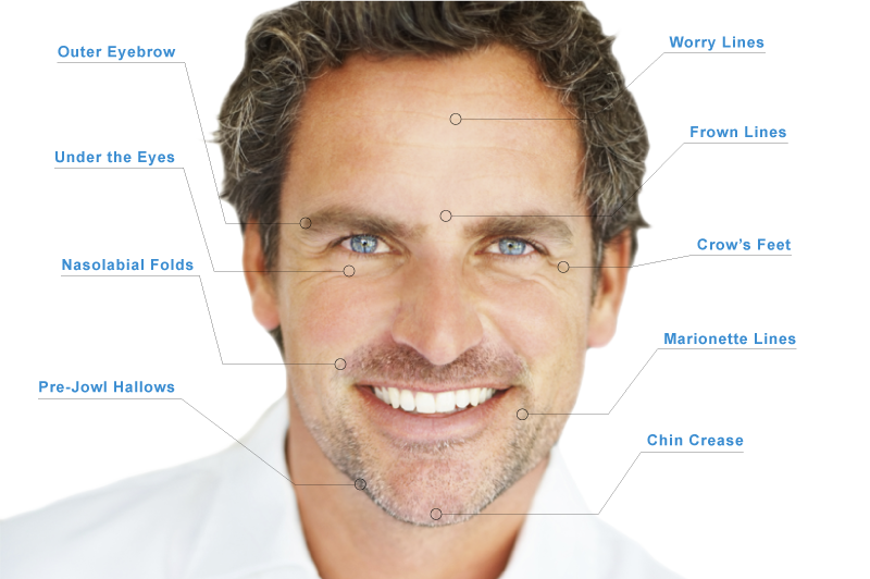 cosmetic injectables for men